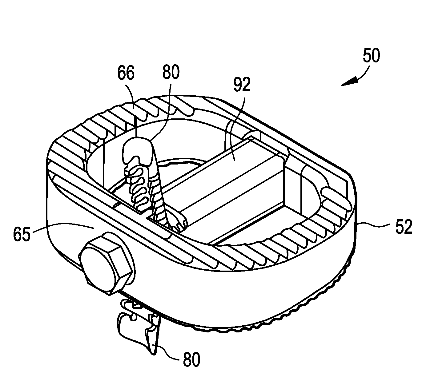 Interbody fusion device and method of operation