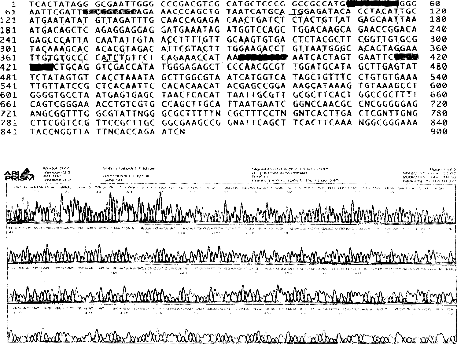 Construction scheme and use of recombinant adeno related virus containing 16 type HPV antisense E7 gene