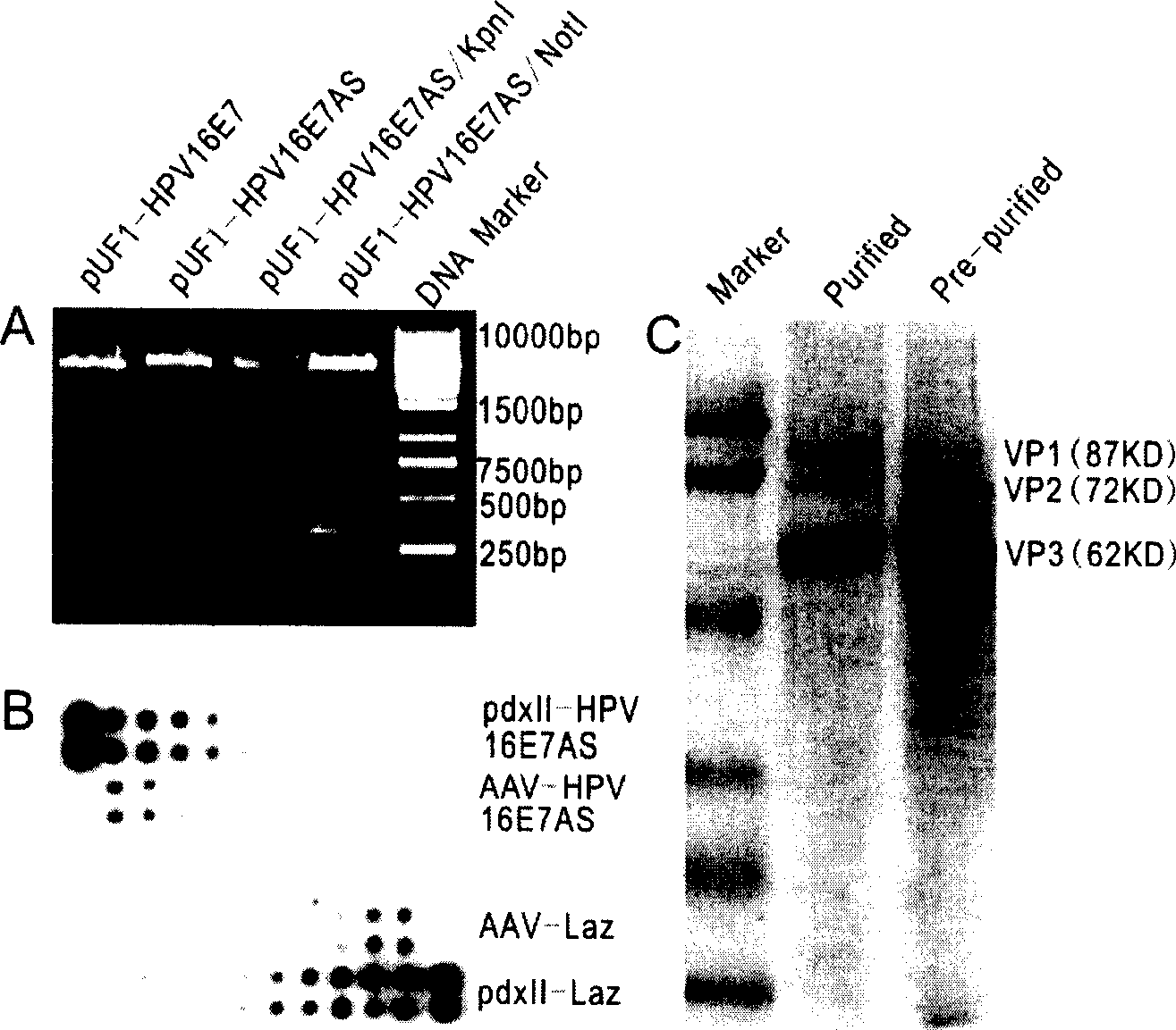 Construction scheme and use of recombinant adeno related virus containing 16 type HPV antisense E7 gene