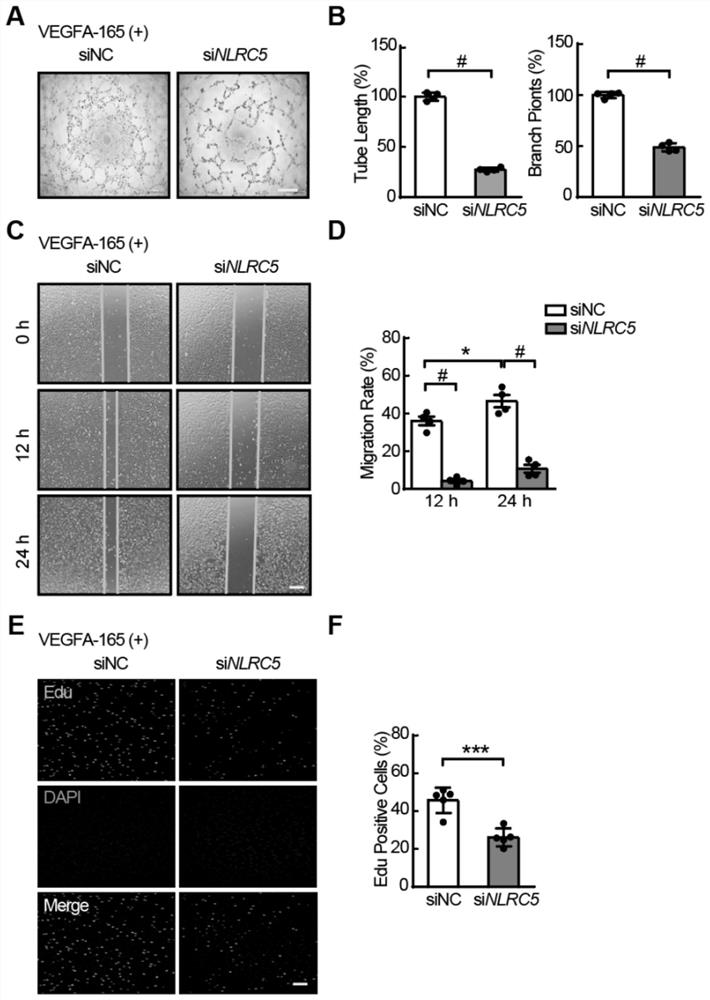 Polypeptide for promoting angiogenesis and pharmaceutical use of polypeptide