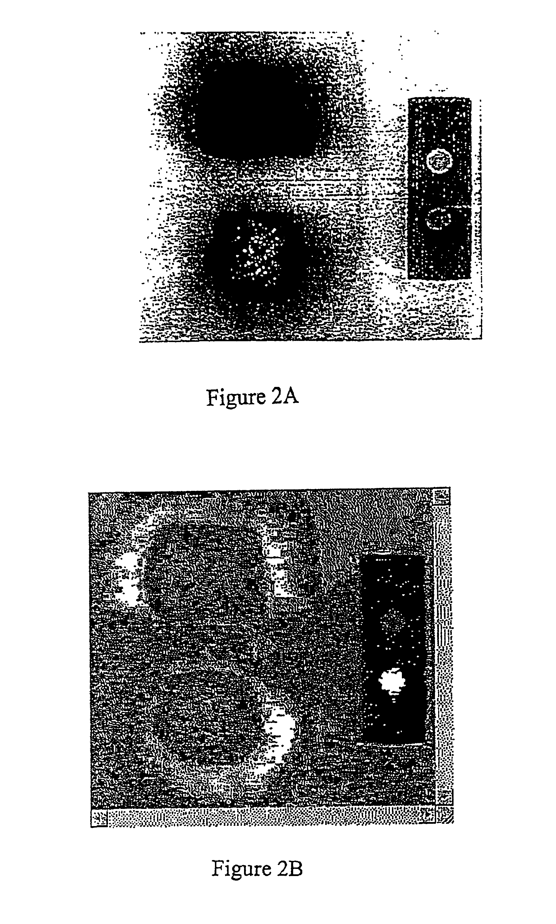 Devices and methods for reading and interpreting guaiac-based occult blood tests