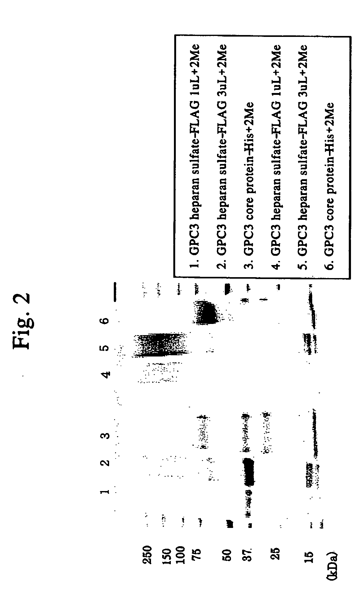 Method for diagnosing cancer by detecting gpc3