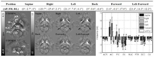 Human brain magnetic susceptibility tensor imaging method based on cross mode