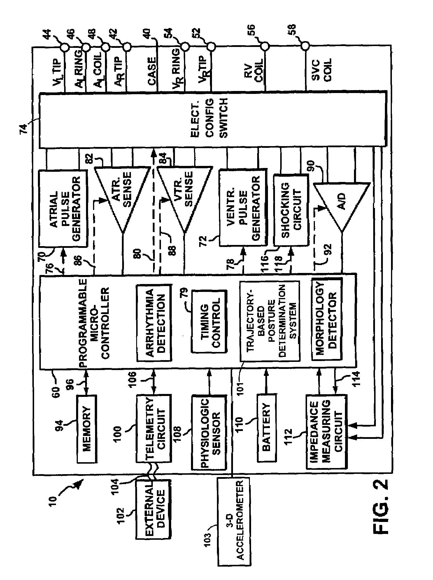 System and method for determining patient posture based on 3-D trajectory using an implantable medical device