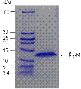 Method for preparing beta2 microglobulin crude product