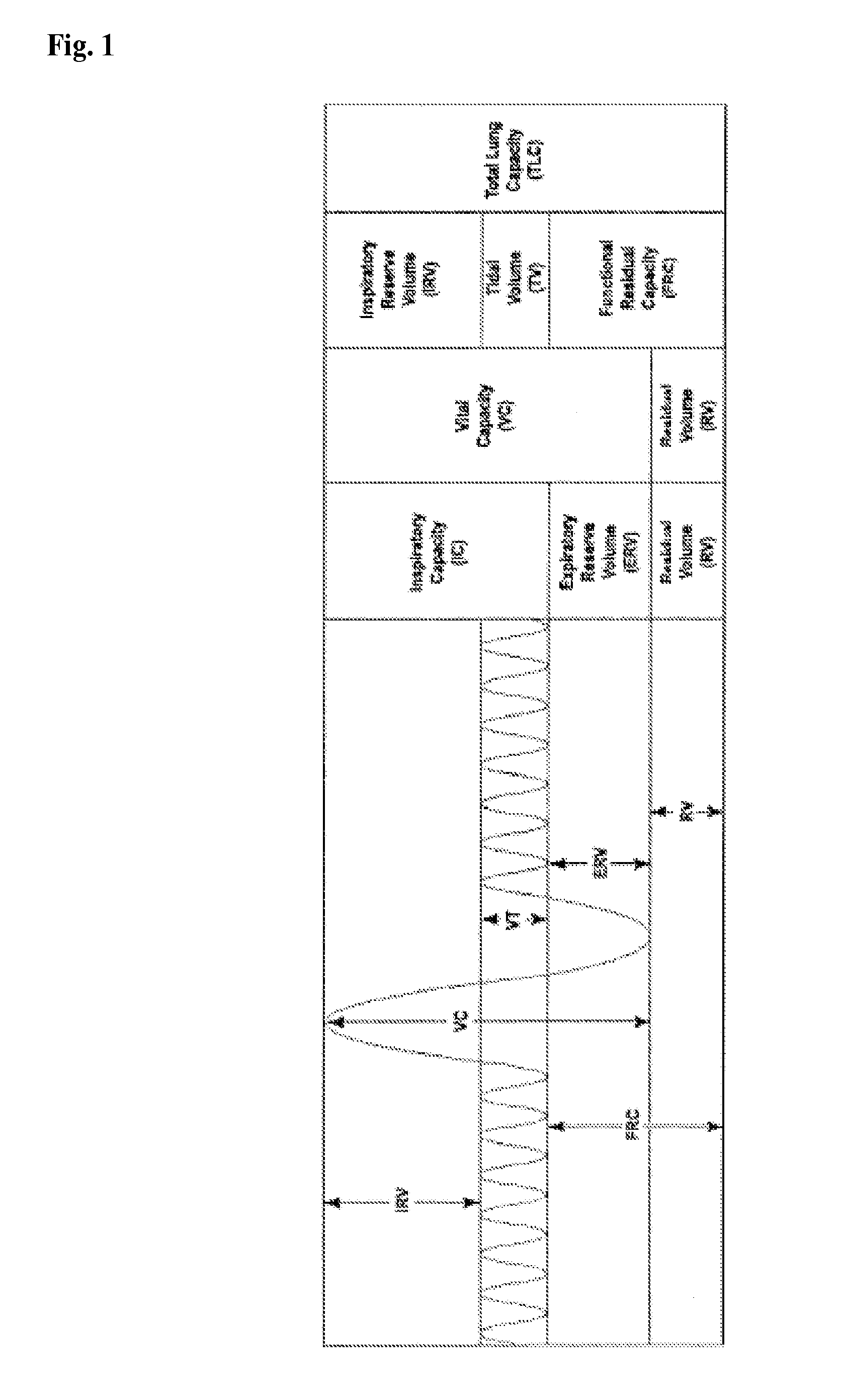 Apparatus and methods for assisting breathing