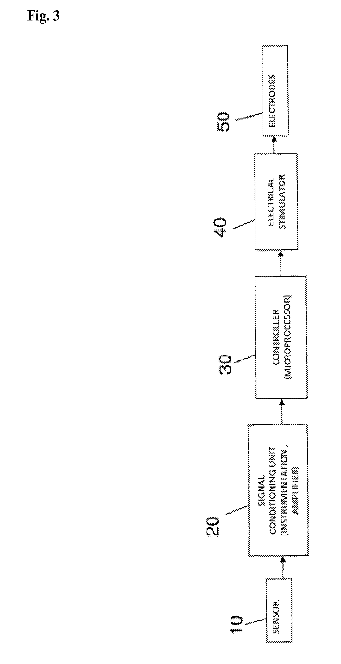 Apparatus and methods for assisting breathing