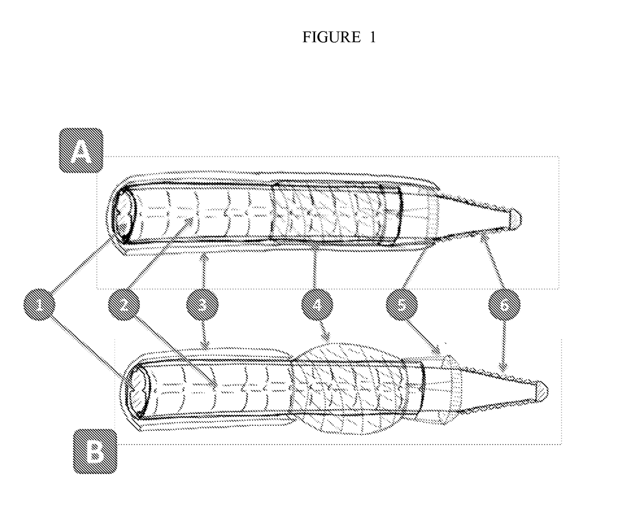 Devices and Methods for Treating Occlusion of the Ophthalmic Artery