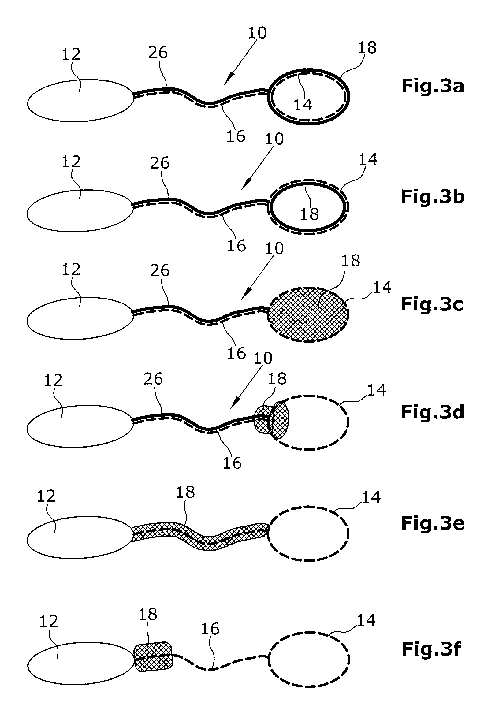 Device for supplying energy to hydraulically or pneumatically actuated active implants