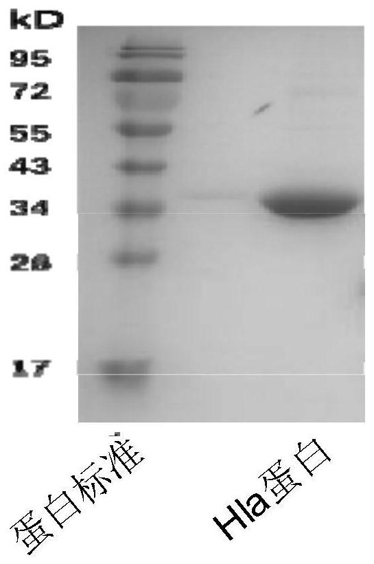 A kind of anti-staphylococcus aureus α-hemolysin monoclonal antibody and its application