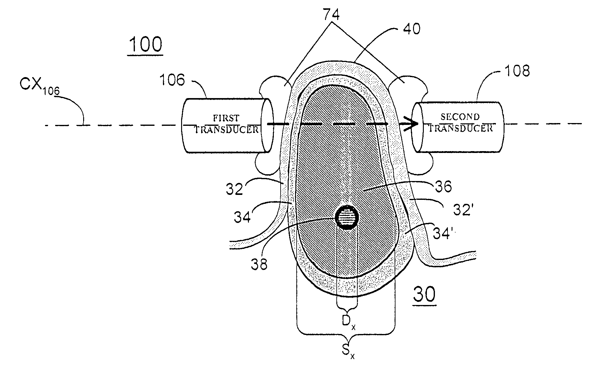 Systems for ultrasonic imaging of a jaw, methods of use thereof and coupling cushions suited for use in the mouth