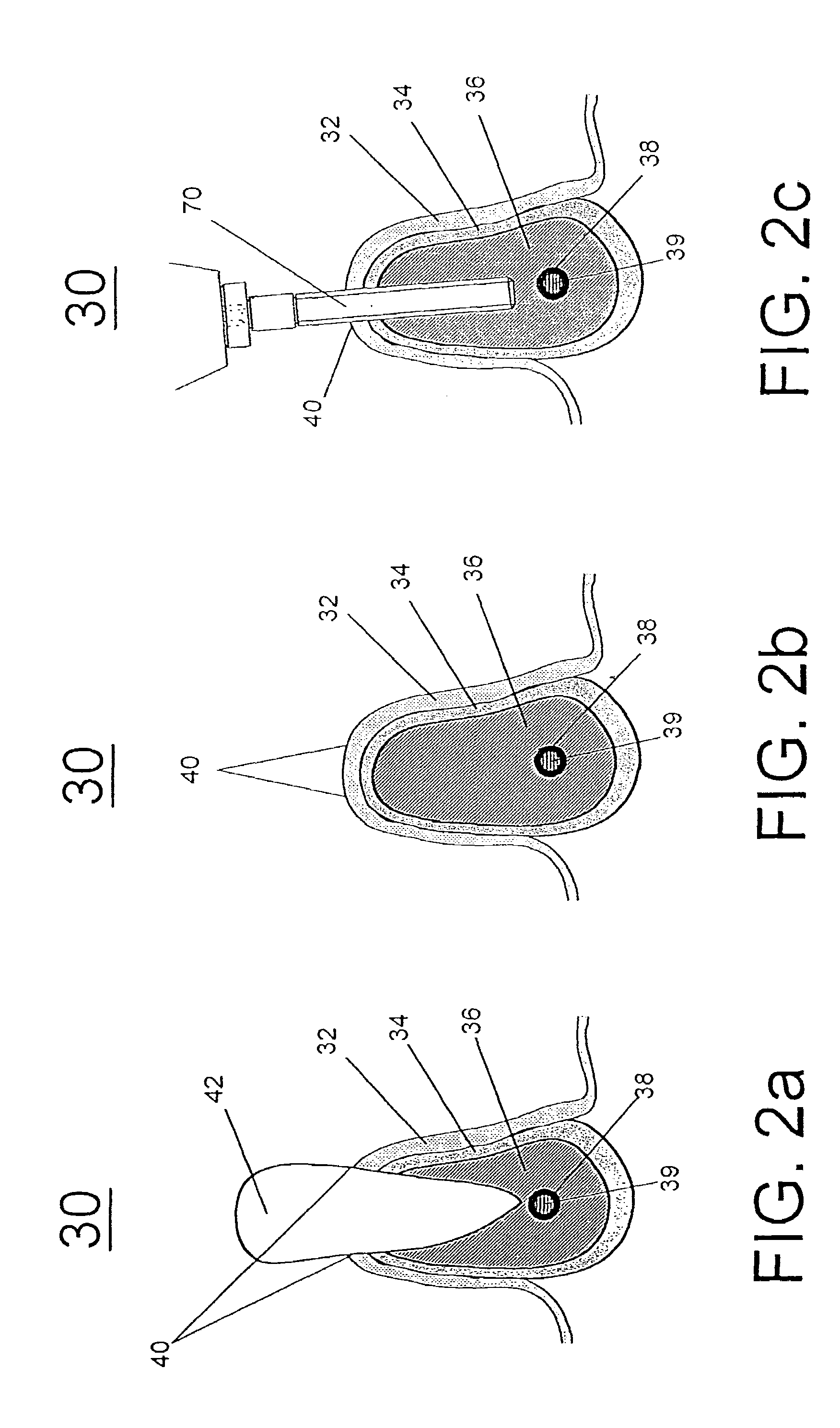 Systems for ultrasonic imaging of a jaw, methods of use thereof and coupling cushions suited for use in the mouth