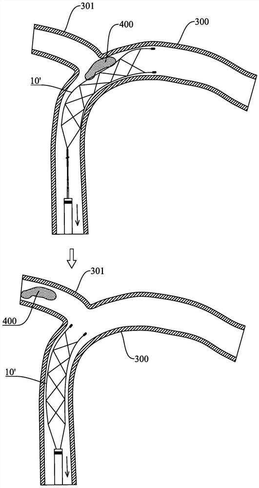 Thrombectomy stent