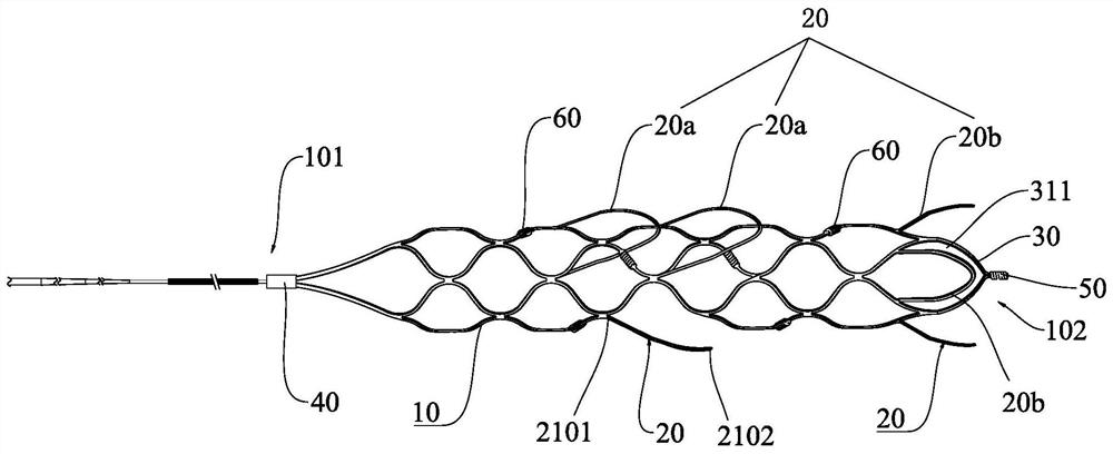 Thrombectomy stent