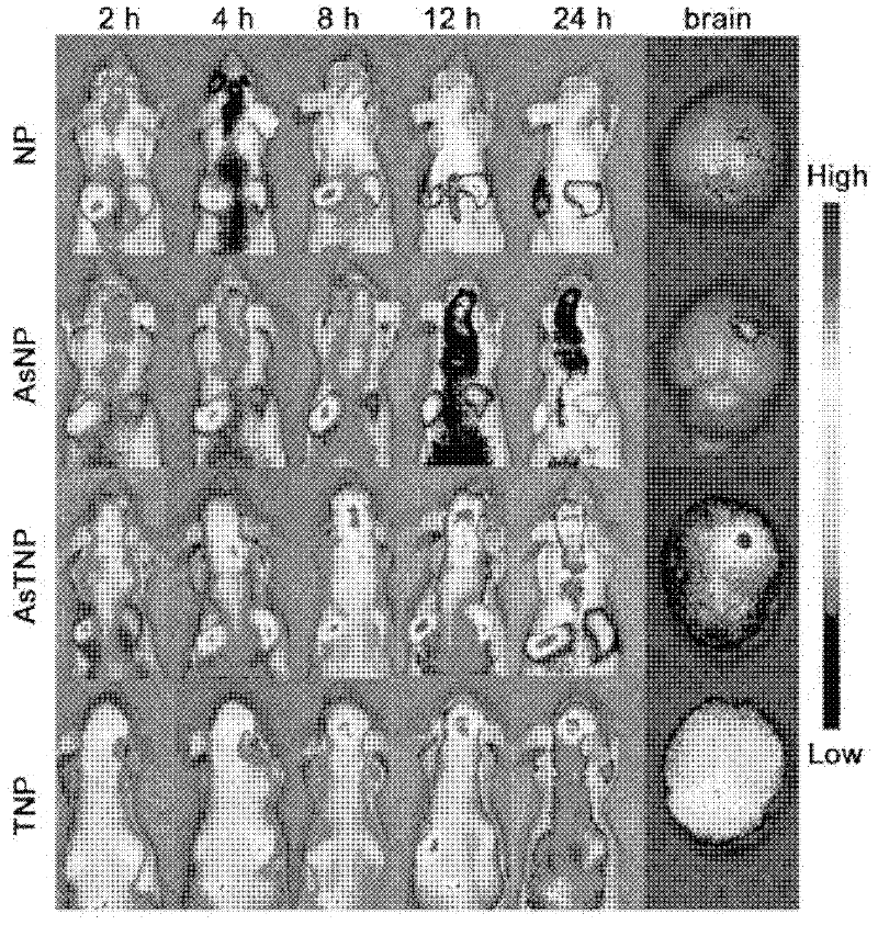 Cascade brain-targeting drug delivery system as well as preparation method and application thereof