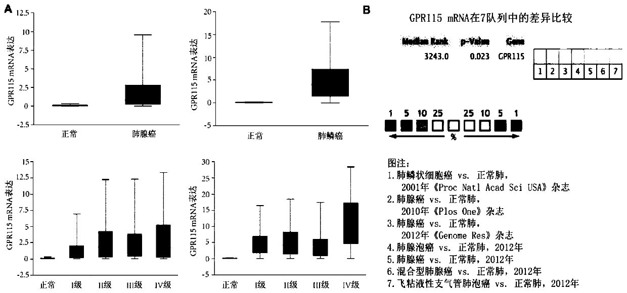 Application of GPR115 gene in preparation of anti-lung cancer drug and diagnostic kit thereof