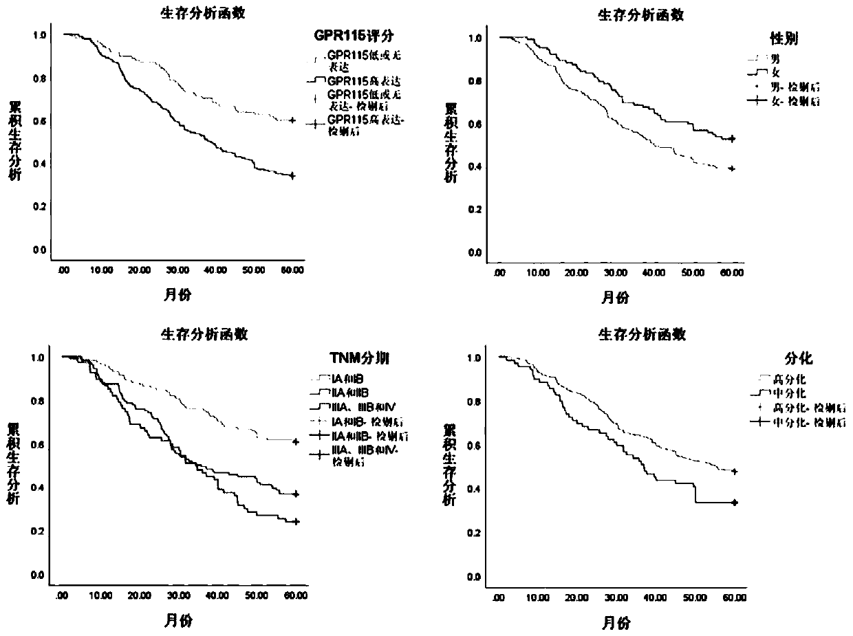 Application of GPR115 gene in preparation of anti-lung cancer drug and diagnostic kit thereof