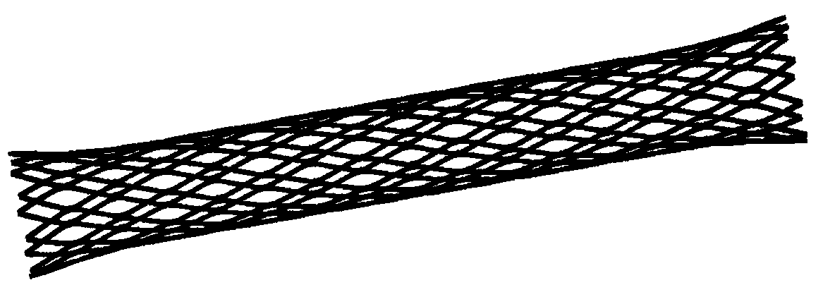 Method for preparing personalized degradable metal stent or internal fixation device based on 3D printing