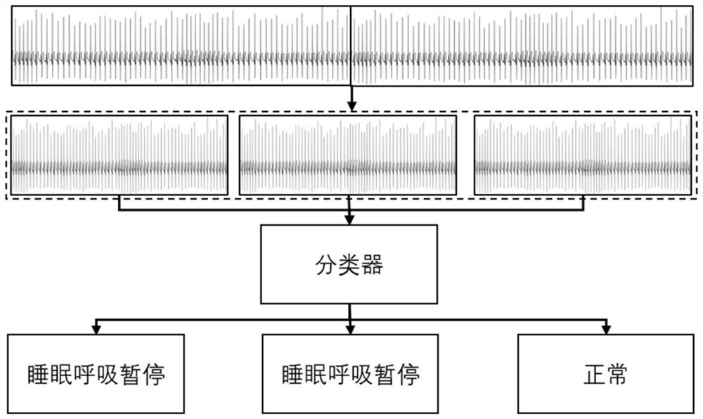 Time-series physiological data classification method, device, storage medium and processor