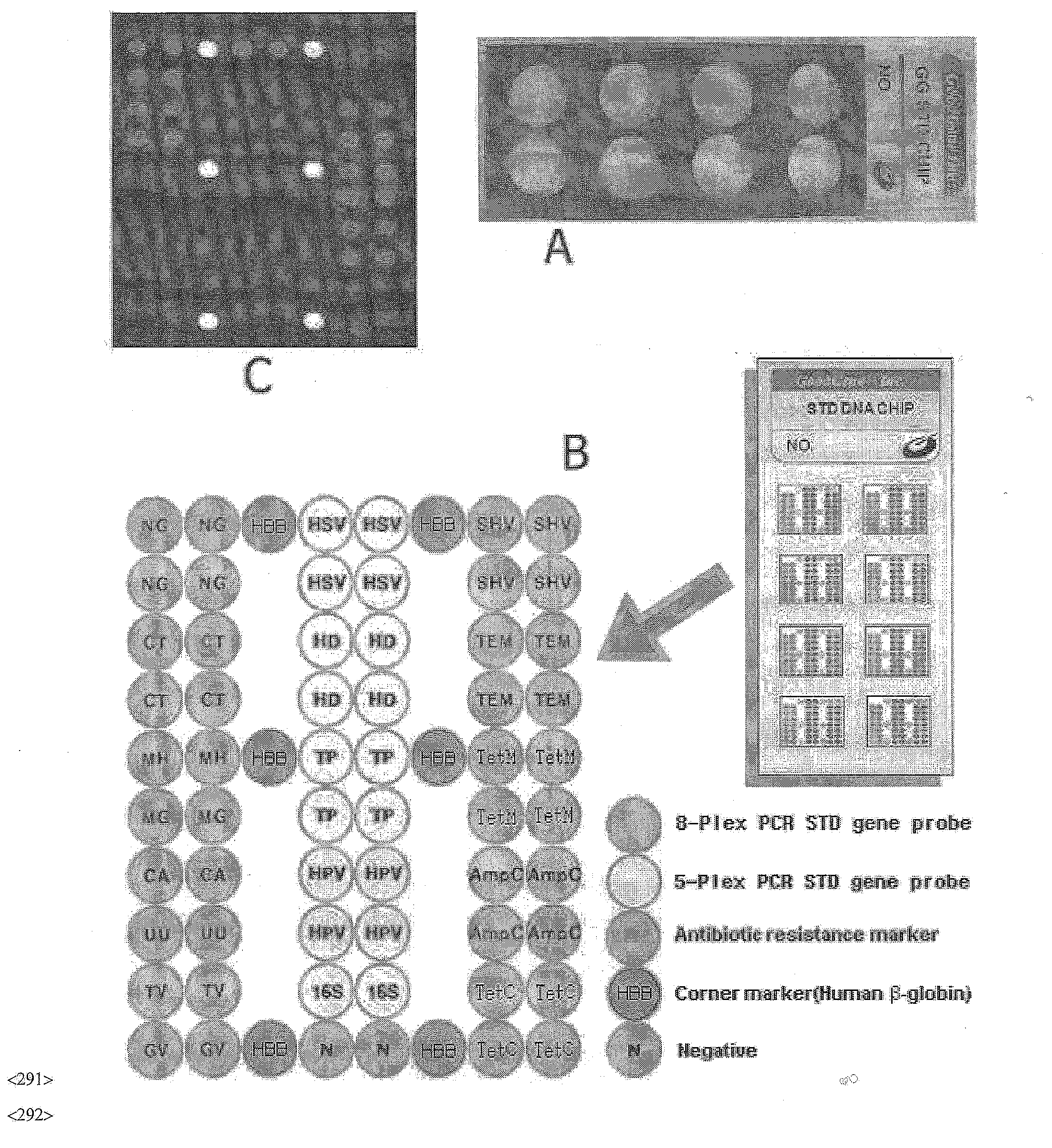DNA chip, kit for detecting or genotyping bacteria causing sexually transmitted diseases, genotyping antibacterial drug resistance and detecting or genotyping method using the same