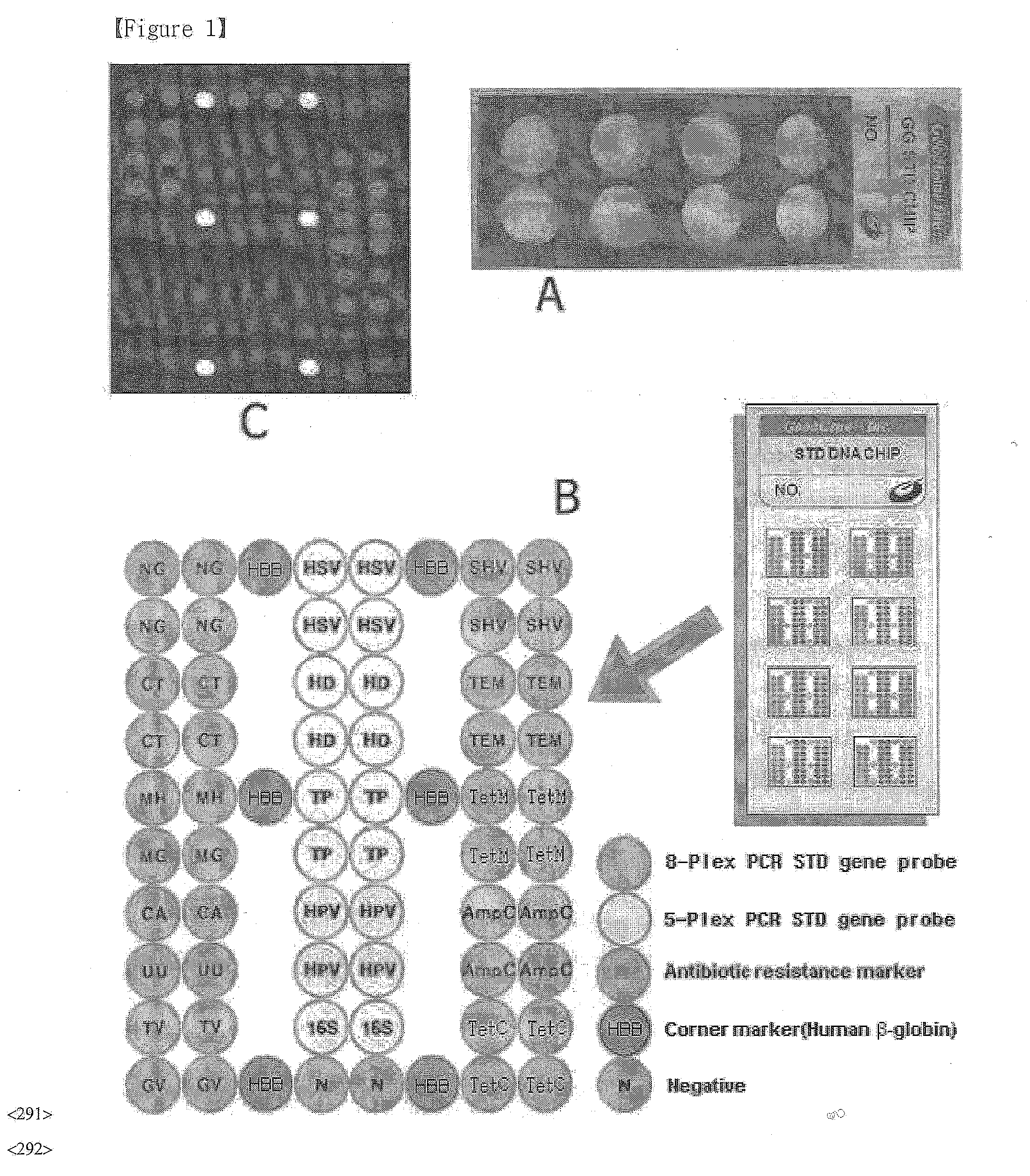 DNA chip, kit for detecting or genotyping bacteria causing sexually transmitted diseases, genotyping antibacterial drug resistance and detecting or genotyping method using the same