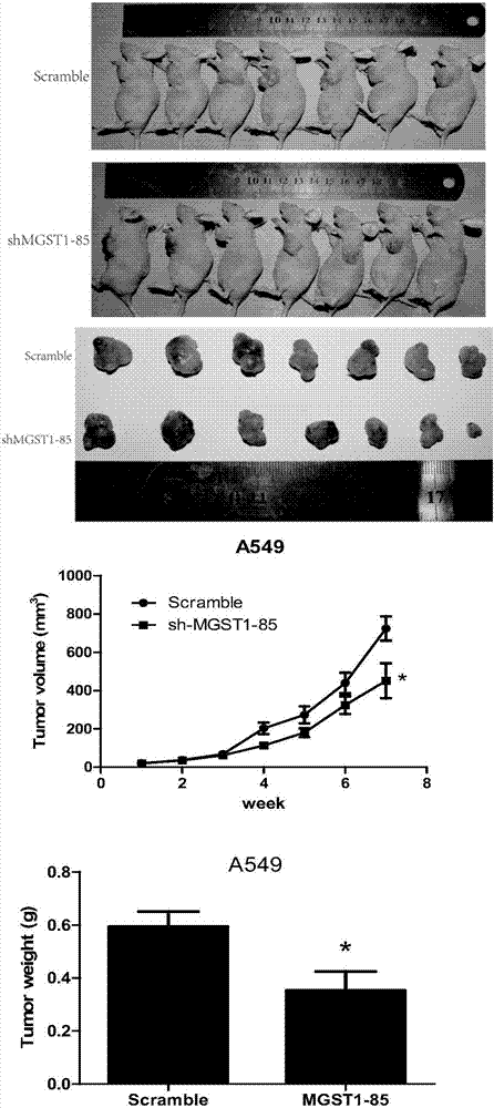 Application of MGST1 gene in proliferation and apoptosis of lung adenocarcinoma cell