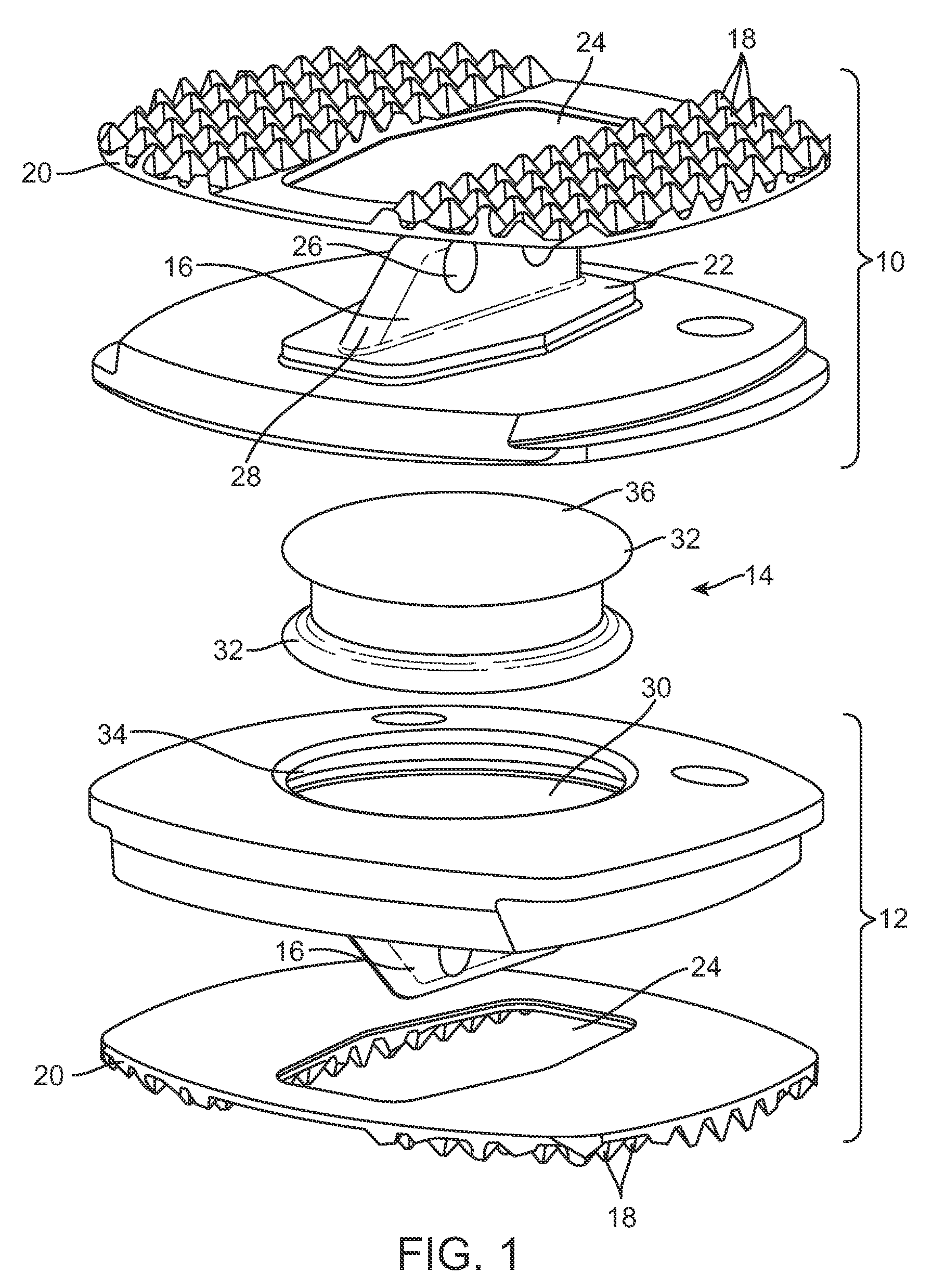 Polyaryletherketone Artificial Intervertebral Disc