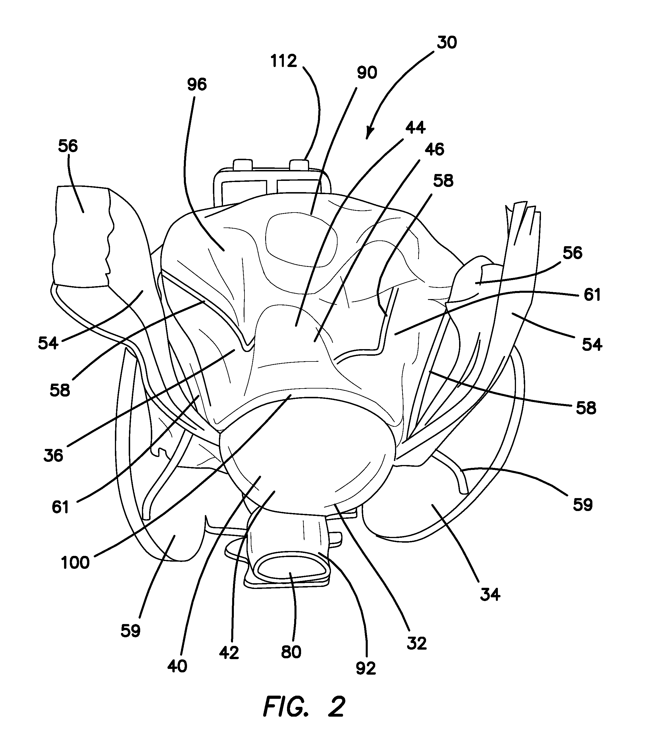 Hysterectomy model