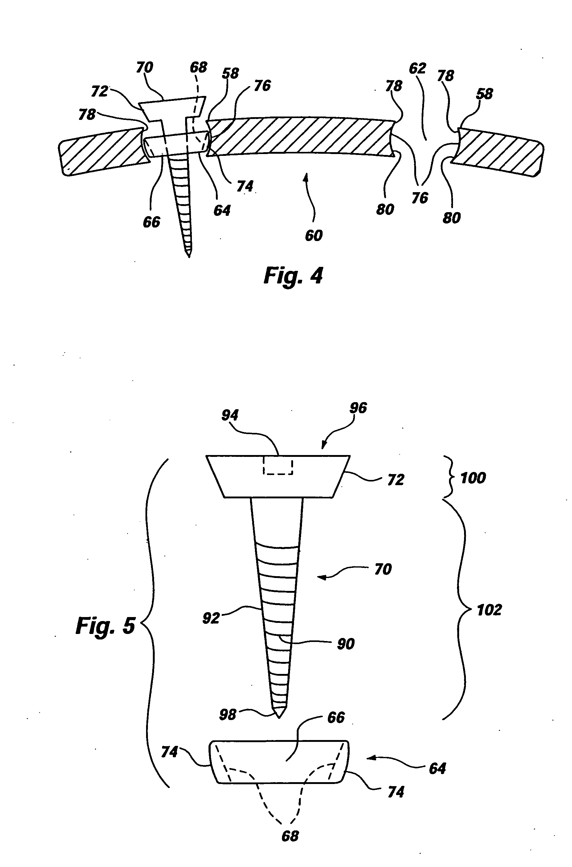 Cervical plate for stabilizing the human spine