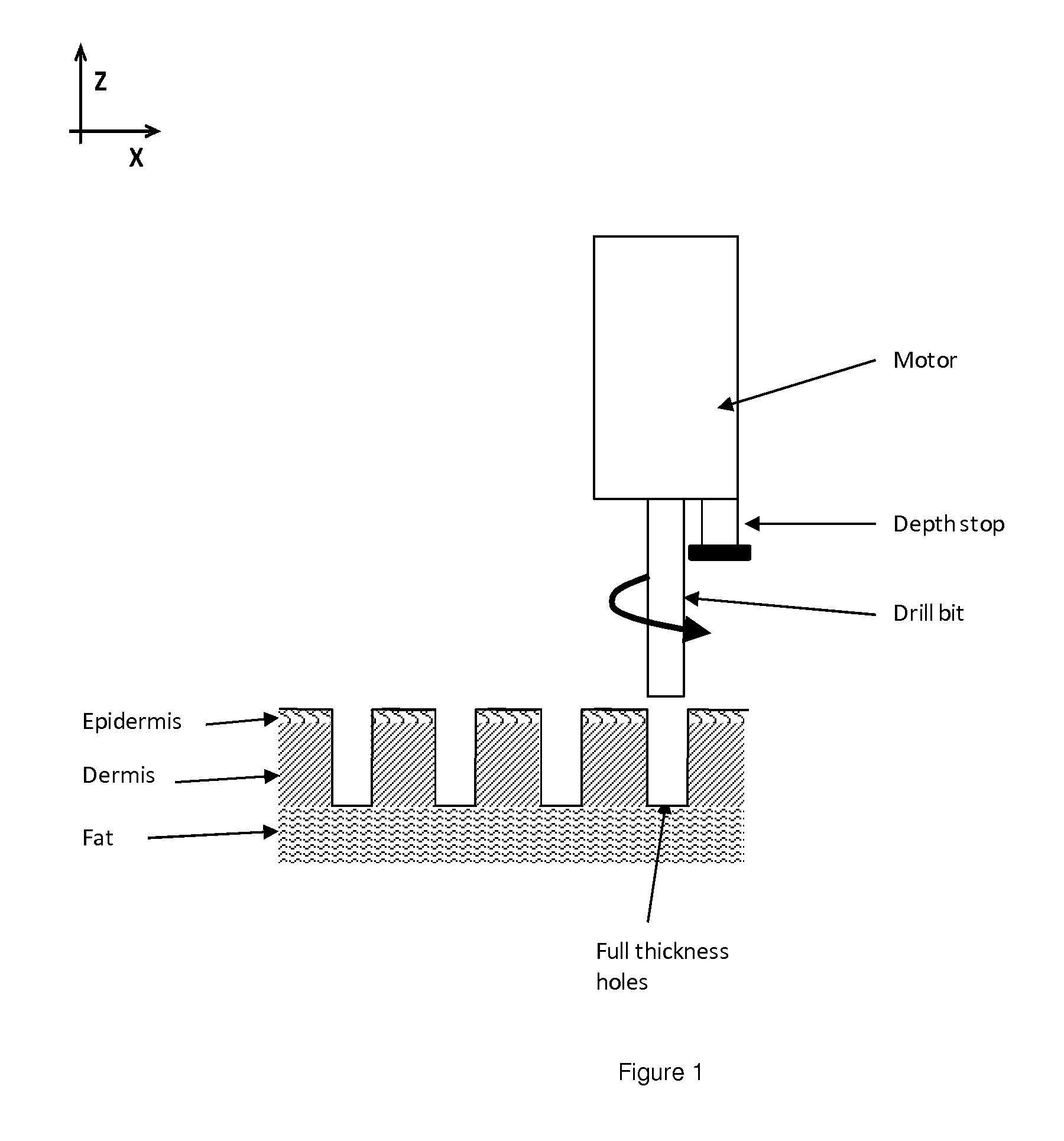 Methods and apparatuses for skin treatment using non-thermal tissue ablation