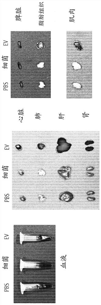 Nanovesicles derived from coprococcus sp. bacteria, and use thereof