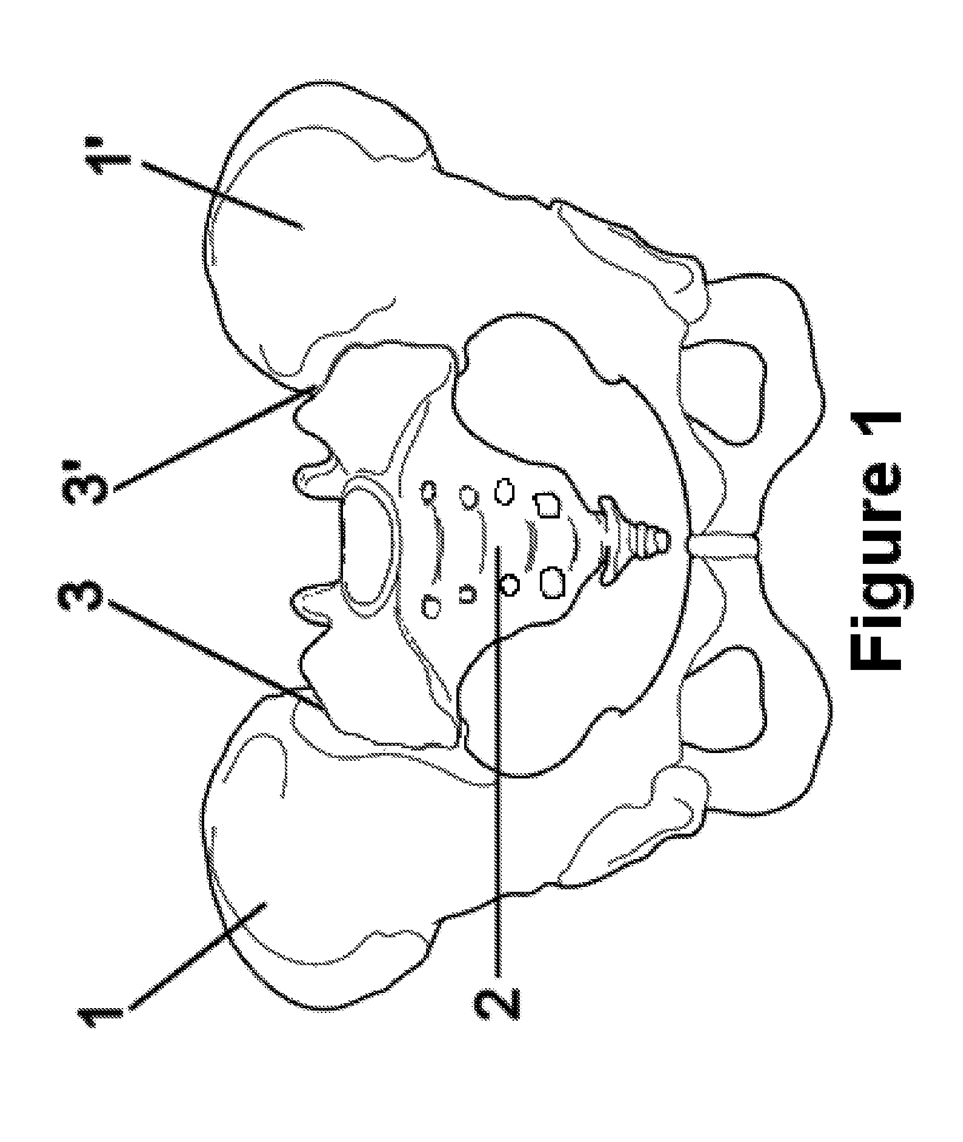 Method for Minimally Invasive Treatment of Unstable Pelvic Ring Injuries with an Internal Posterior Iliosacral Screw and Bone Plate