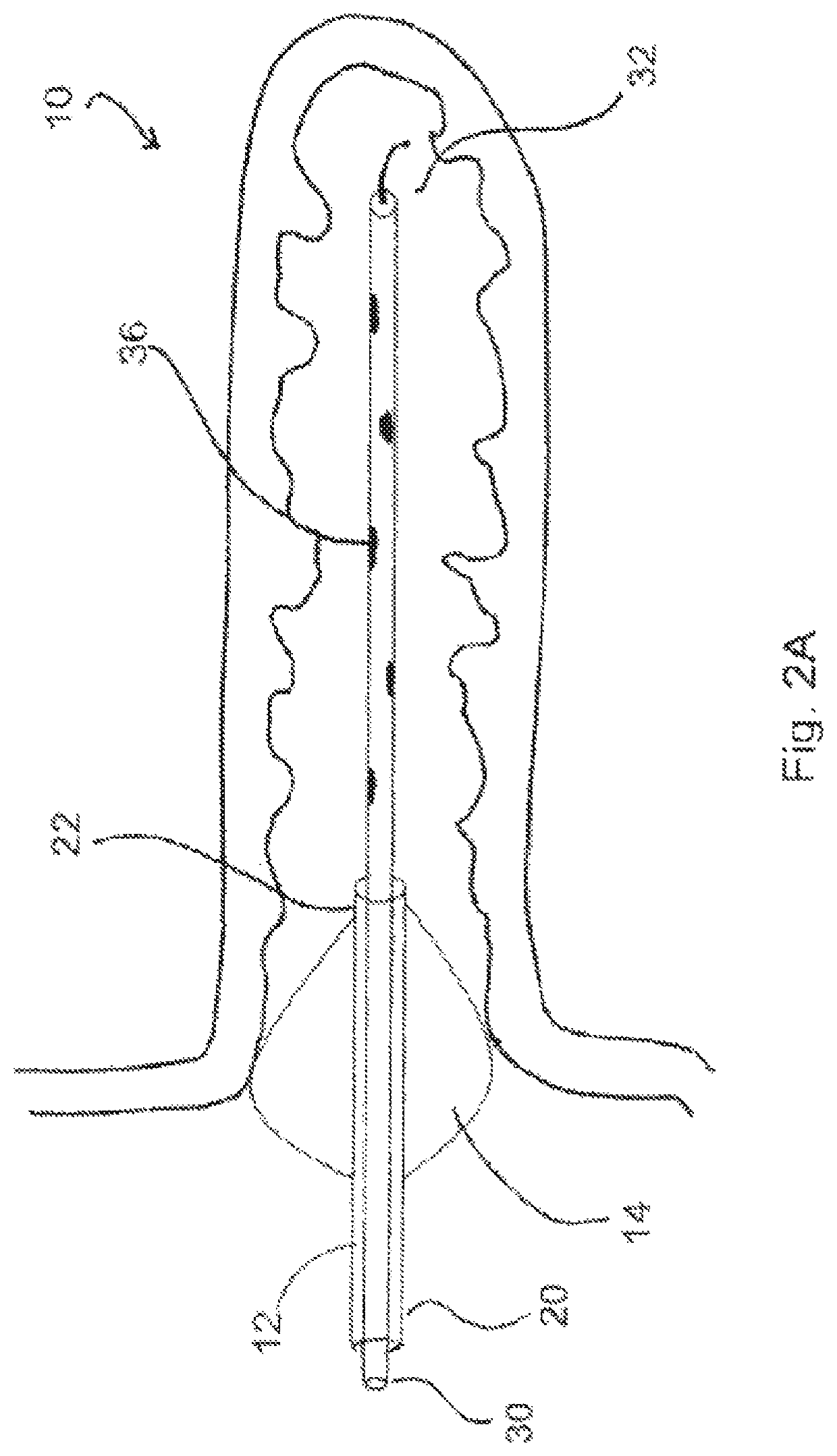 Devices, systems, and methods for atrial appendage occlusion using light cure