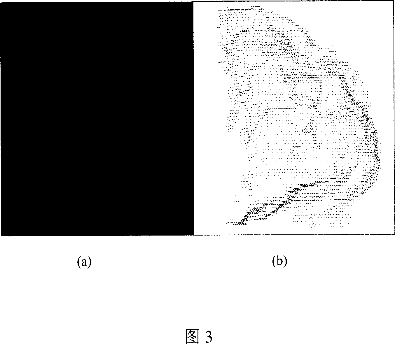 Quantitative analysis method for cerebral cortex complexity during treating three-D magnetoencepha-resonance data