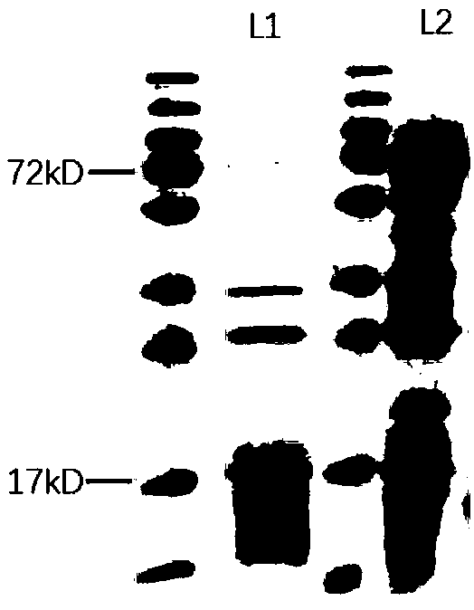 Extraction and separation purification methods for main allergenic protein Bet v 8 from birch pollen and application