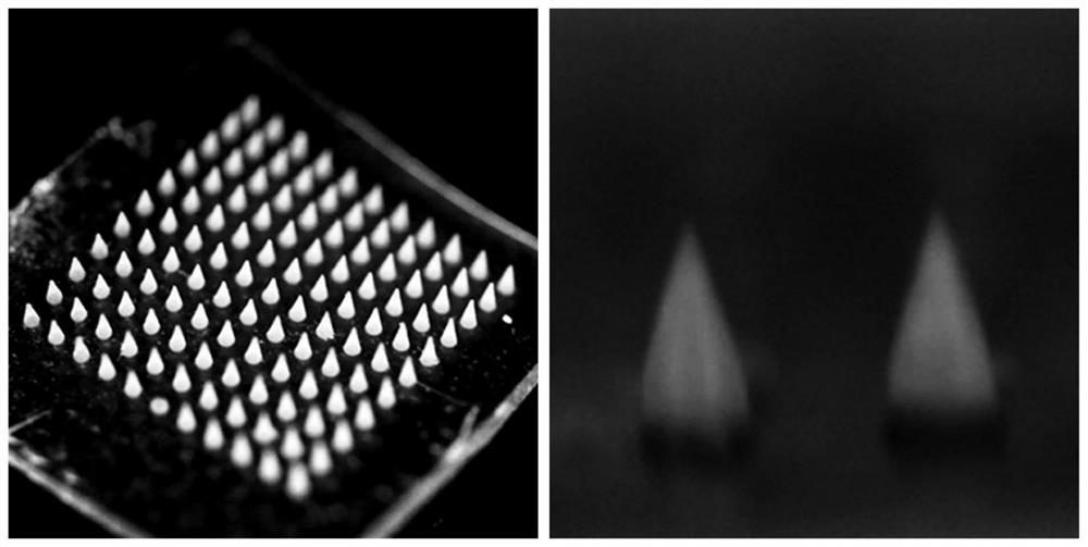 Double-layer conductive microneedle patch for treating subcutaneous tumor and preparation method and application thereof