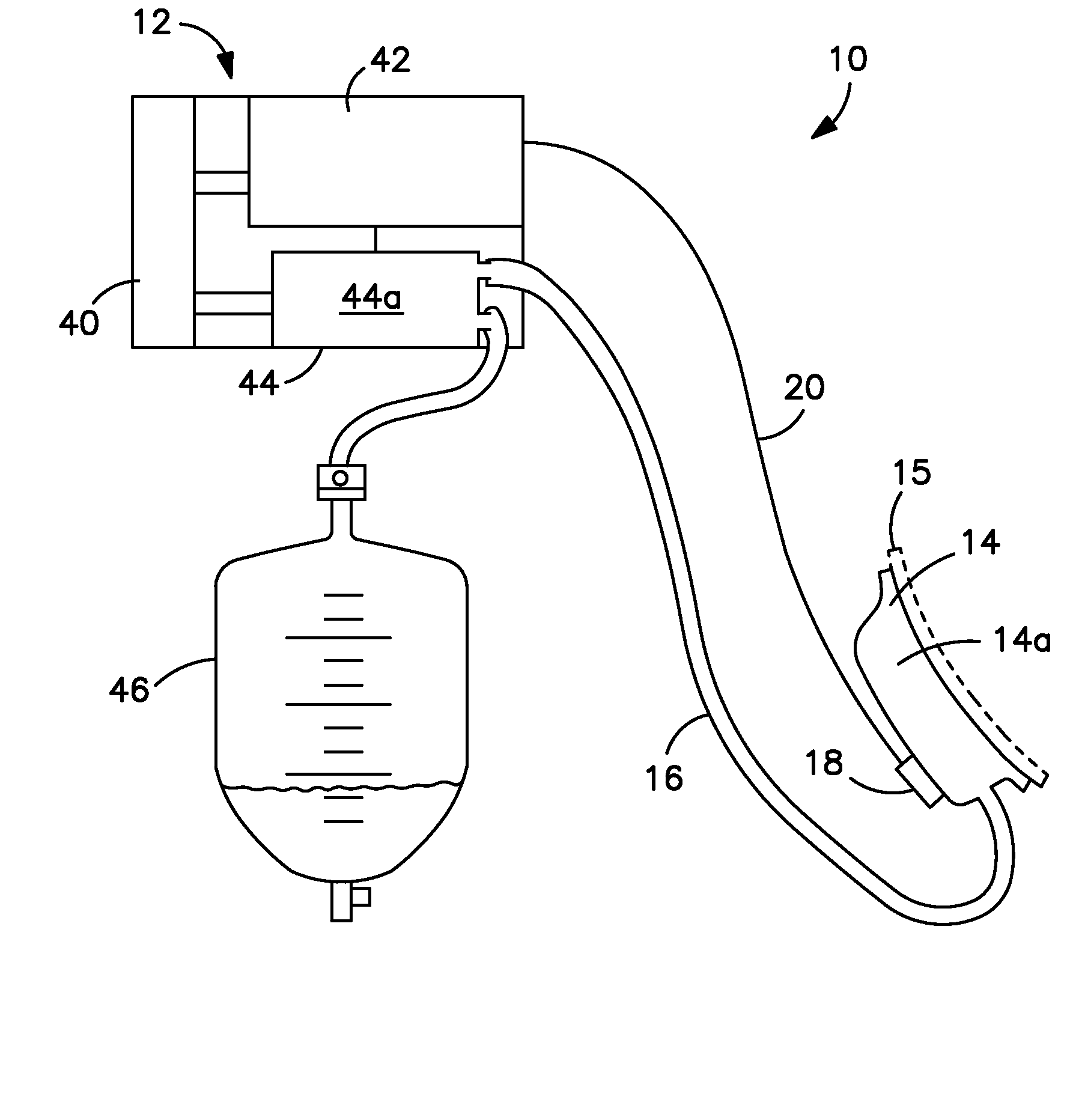 Aspiration system for removing urine discharged by the human body, and liquid sensor therefor