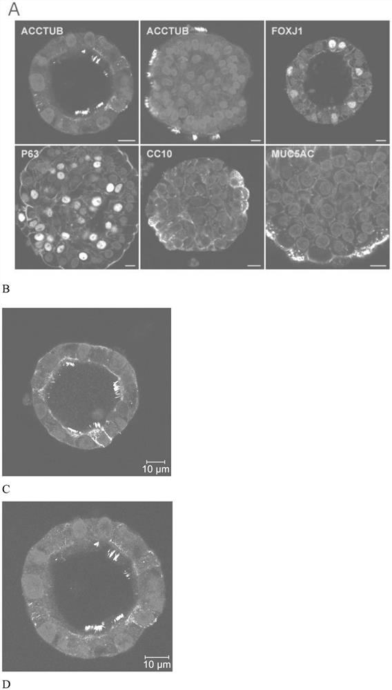 Respiratory tract organoid culture system and method for constructing bocavirus infection model