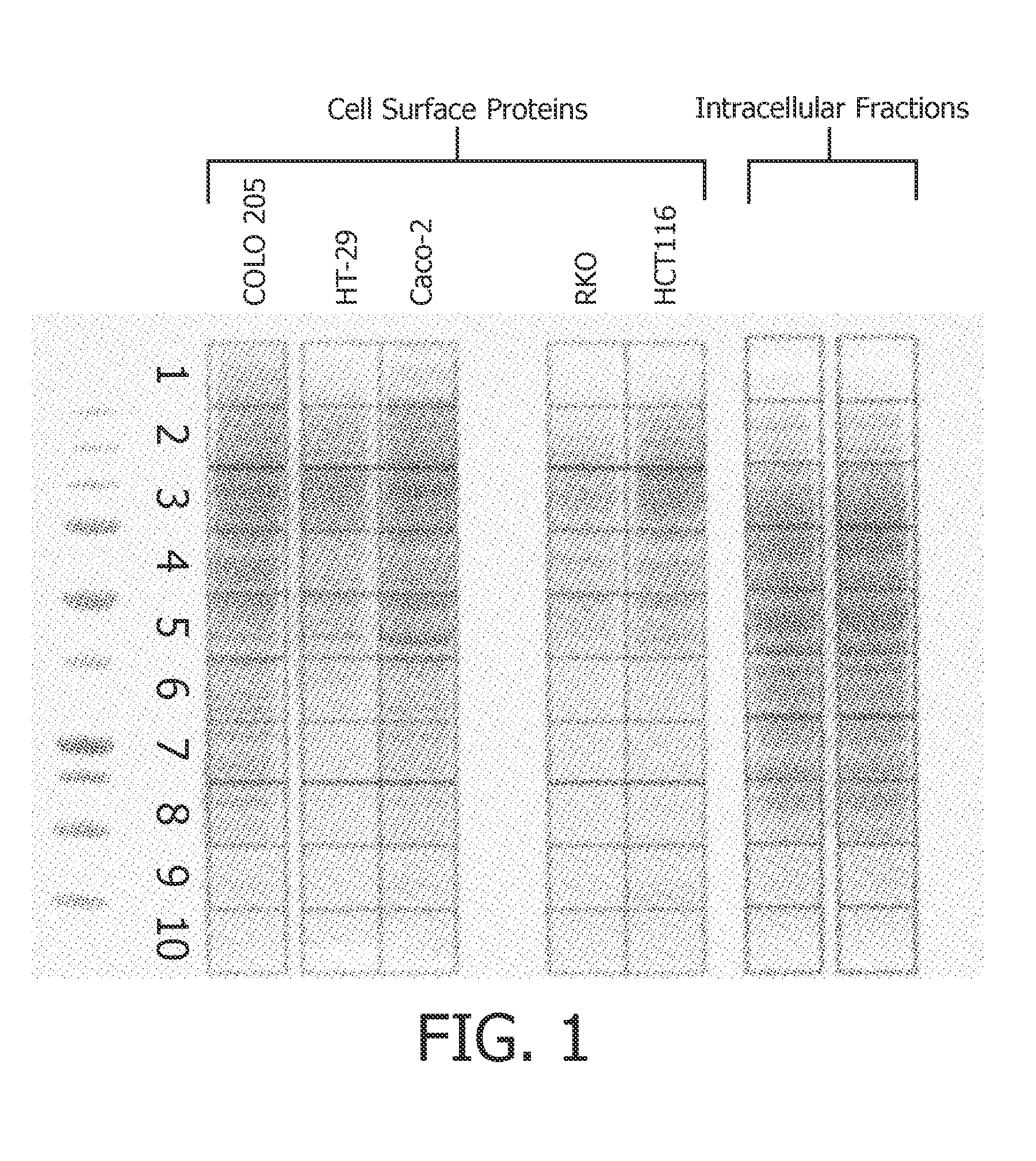 Protein-based methods and compositions for the diagnosis of colorectal adenocarcinoma