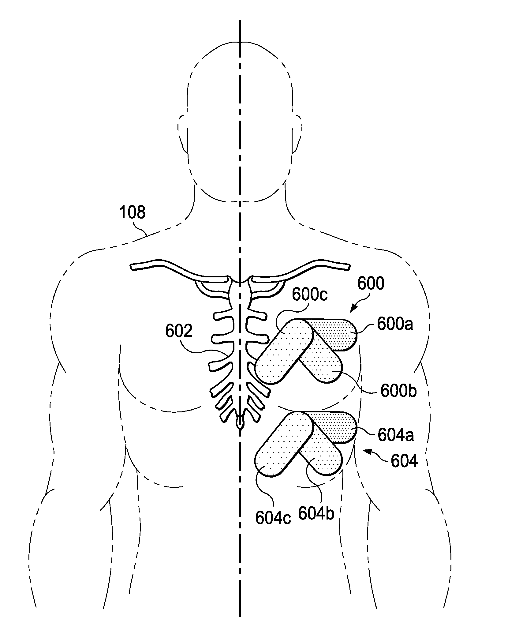 Motion-based seizure detection systems and methods