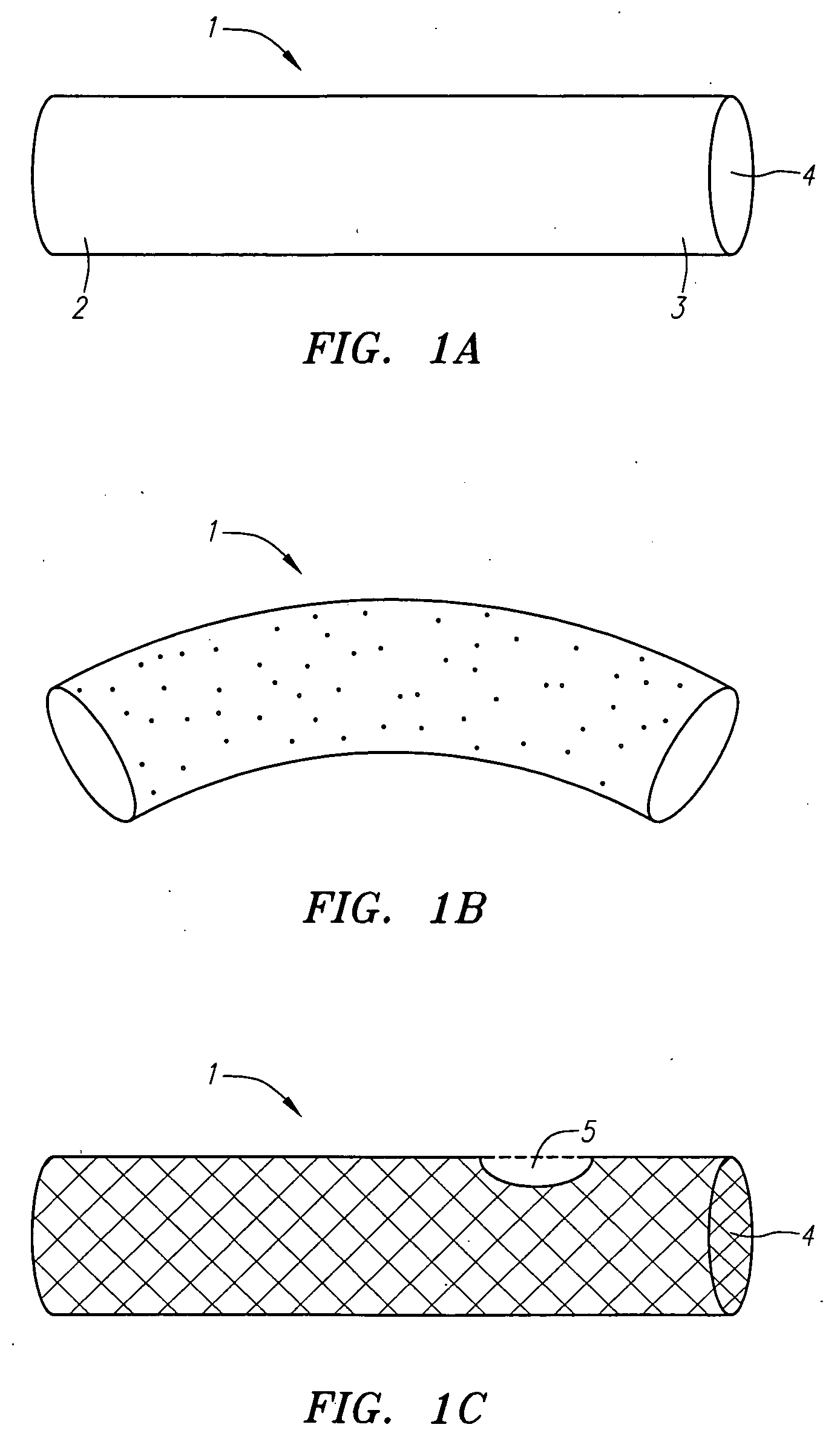 Methods and devices for treating aortic atheroma