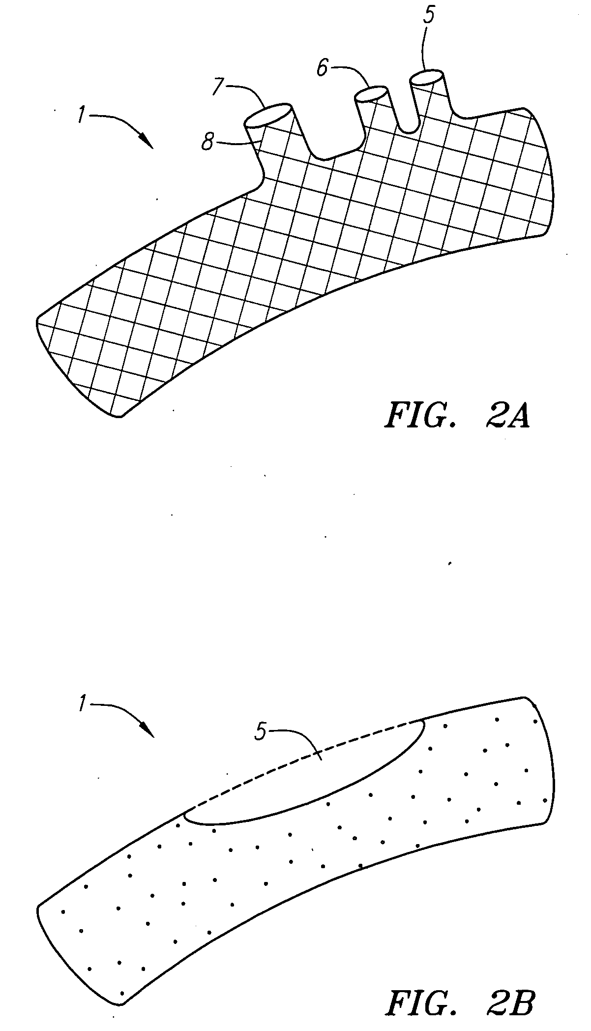 Methods and devices for treating aortic atheroma