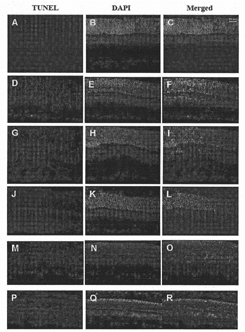 Long-acting sustained release preparation for preventing or treating retinal damage, and preparation method thereof