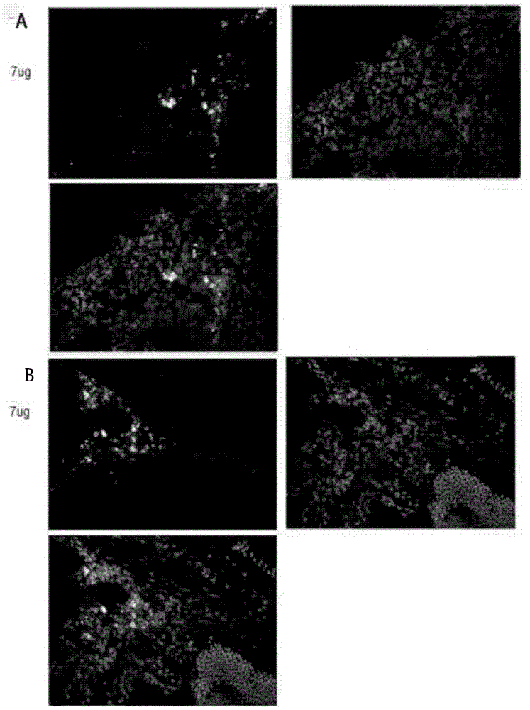 Drug for treating glaucoma