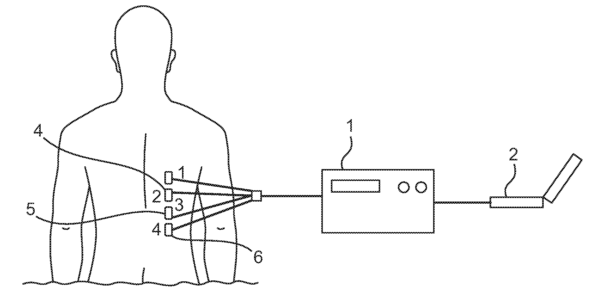 Devices and methods for non-invasive ventilation therapy