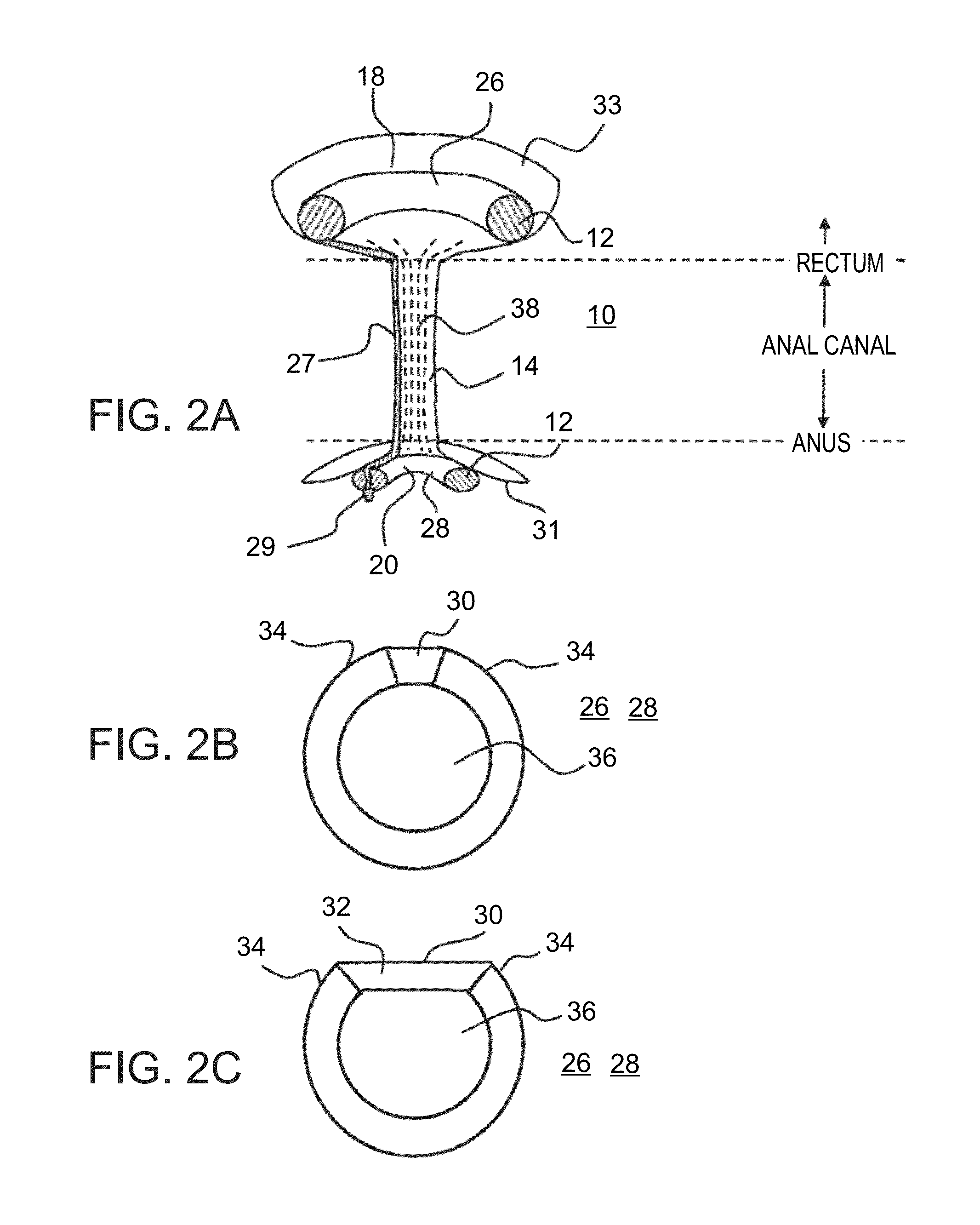 Device for protecting hemorrhoids