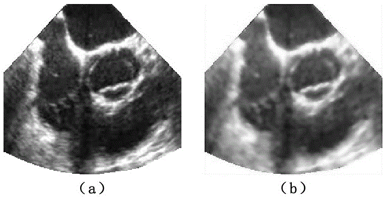 Segmentation method of aortic valve ultrasound image sequence based on gcv model based on inter-frame shape constraints