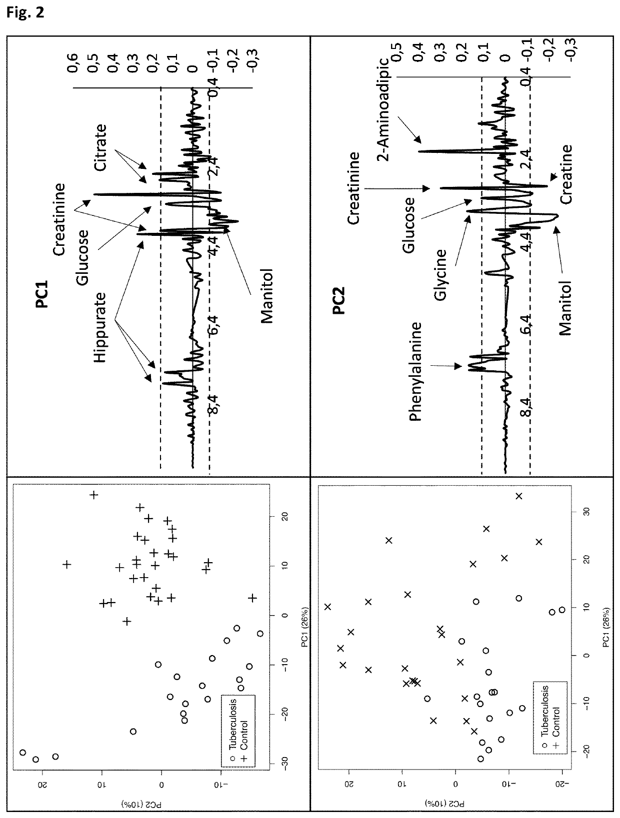 Identification of metabolomic signatures in urine samples for tuberculosis diagnosis