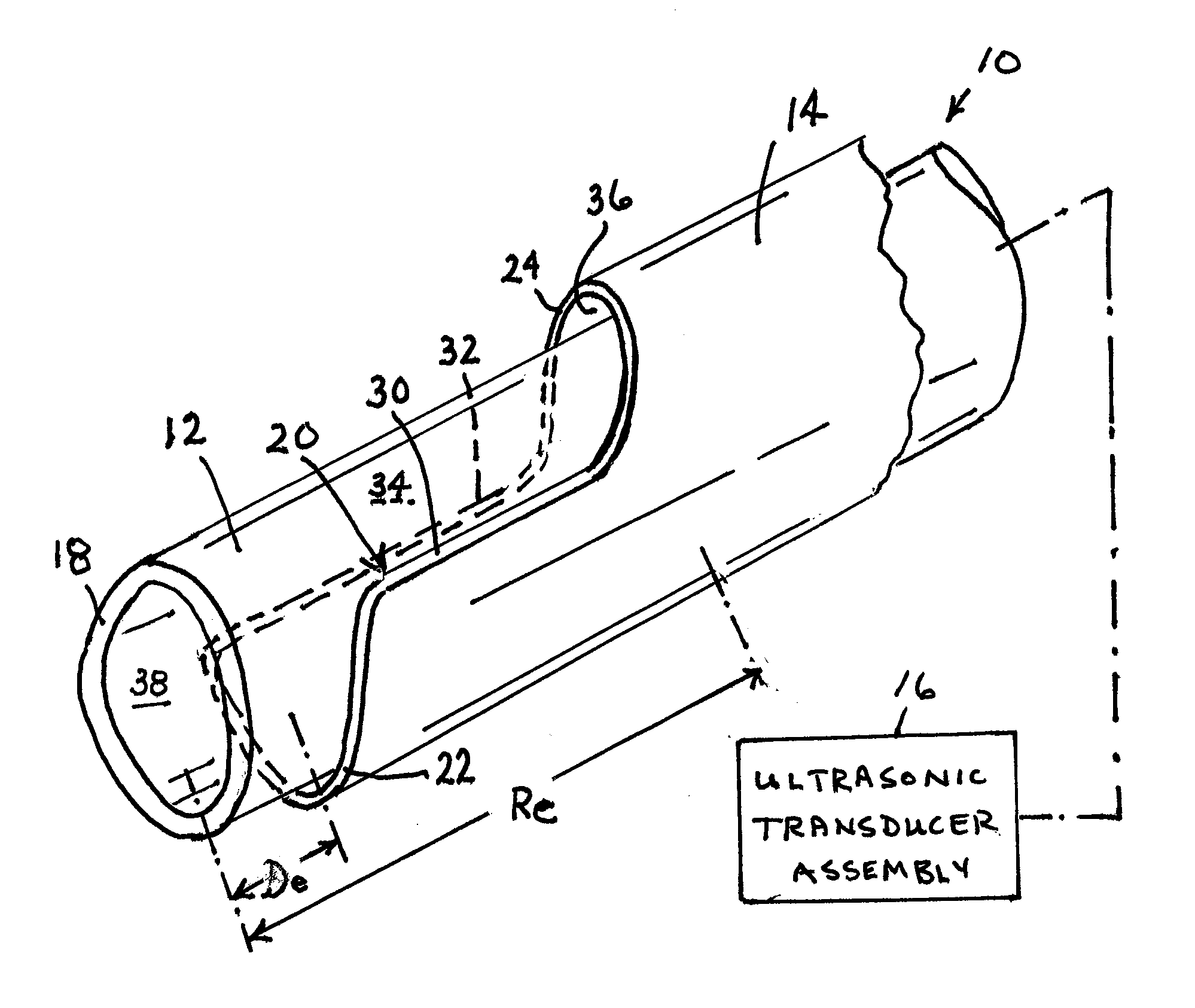 Protective sleeve and associated surgical method