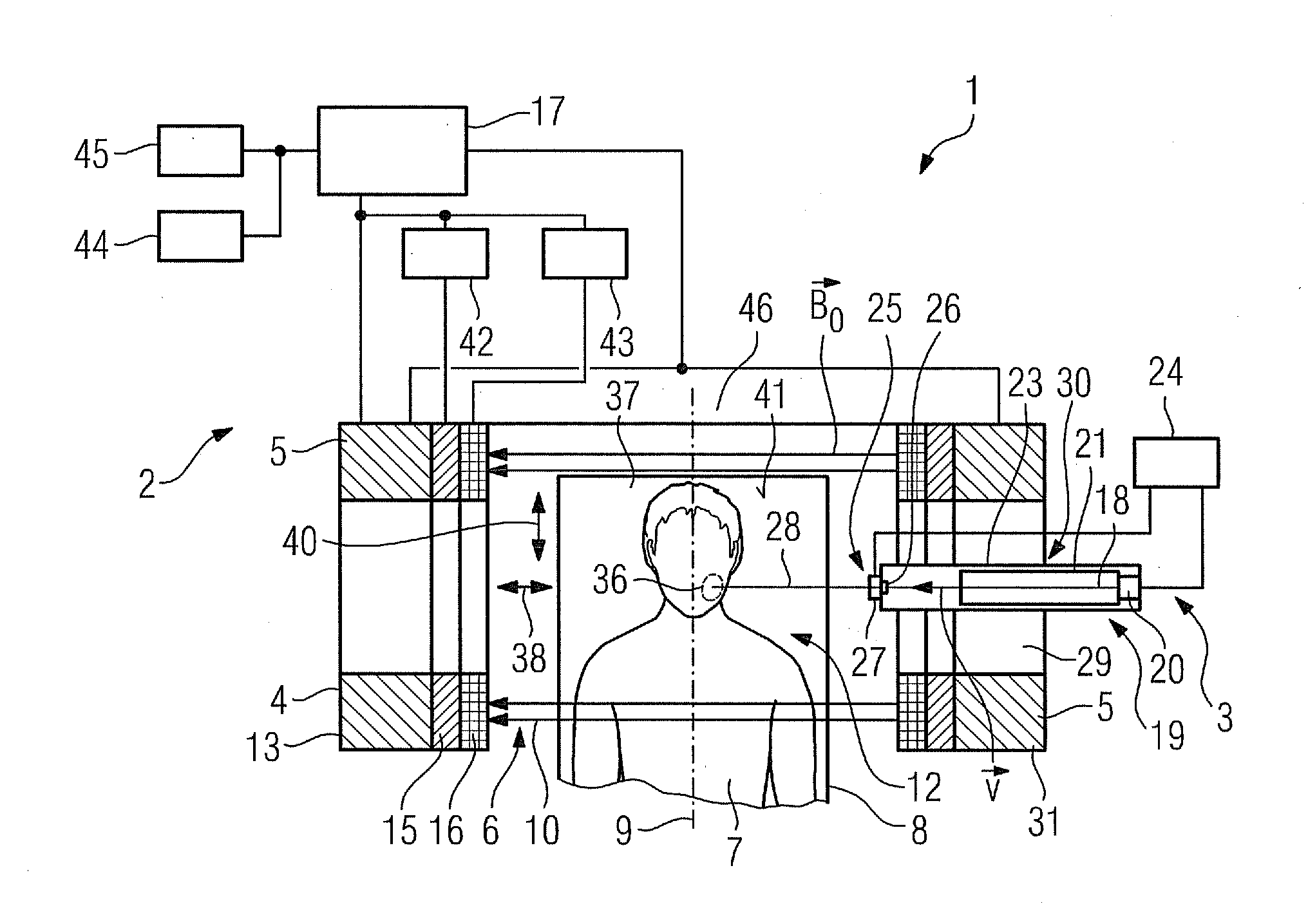 Apparatus with a Combination of a Magnetic Resonance Apparatus and a Radiotherapy Apparatus